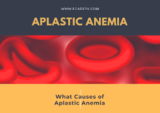 What is Aplastic Anemia? What Causes of Aplastic Anemia?