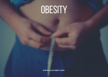 Obesity Problem and The Relationship of Stoutness with Type 2 Diabetes