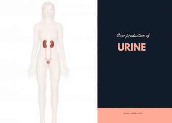 Overproduction of Urine their Cause and Treatment at Home What Indications Apply for Overactive Bladder