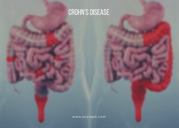 What is Crohin,s Disease Prognosis Impact of Crohn’s Disease on Emotional and Mental Health