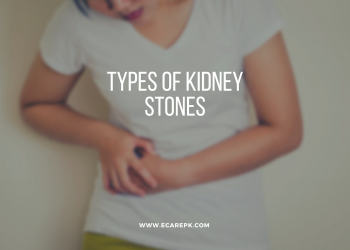 How Many Different Varieties of Kidney Stones are there in the Human Body?