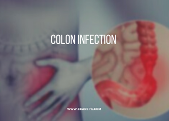 What is Colon Infection Mode of Causes Their Symptoms and Treatment with Detail